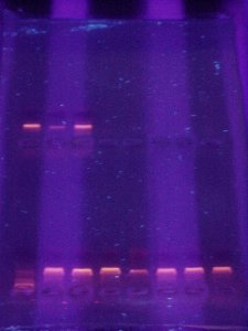 Electroforesis en gel de agarosa de mol�culas de ADN